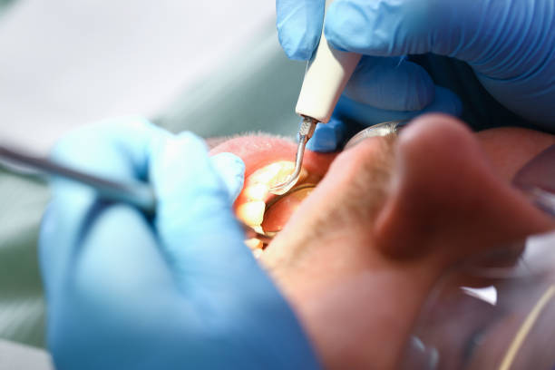 Best Broken or Chipped Tooth Repair in Callahan, FL