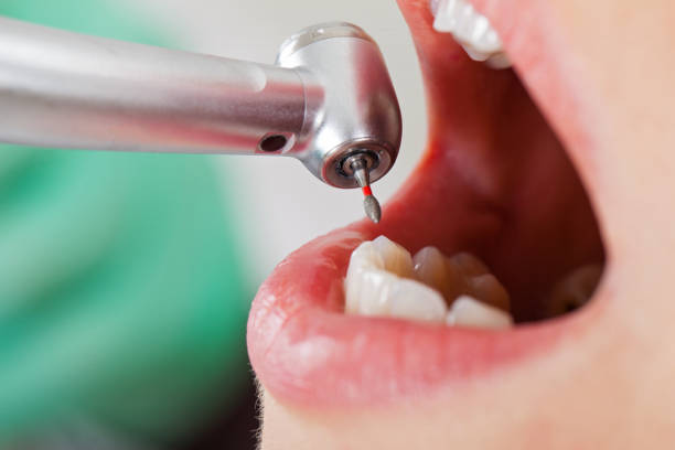 Best Emergency Care for Gum Disease in Callahan, FL